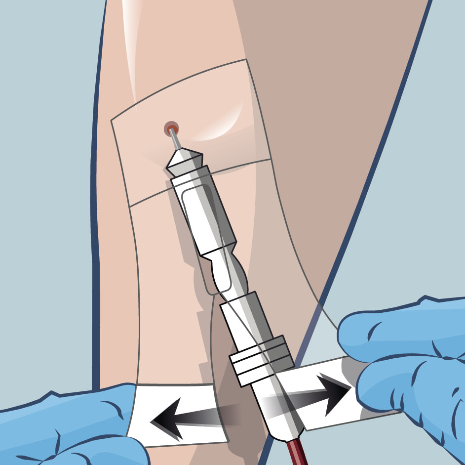 Step 2