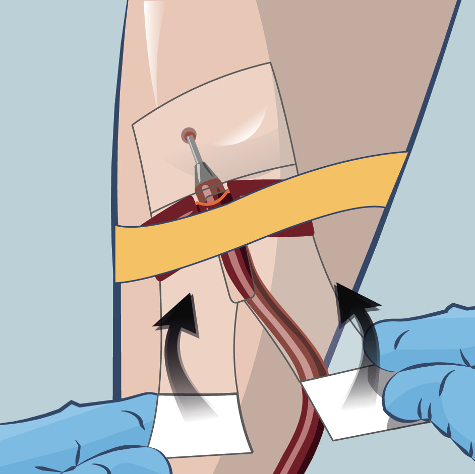 Step 3